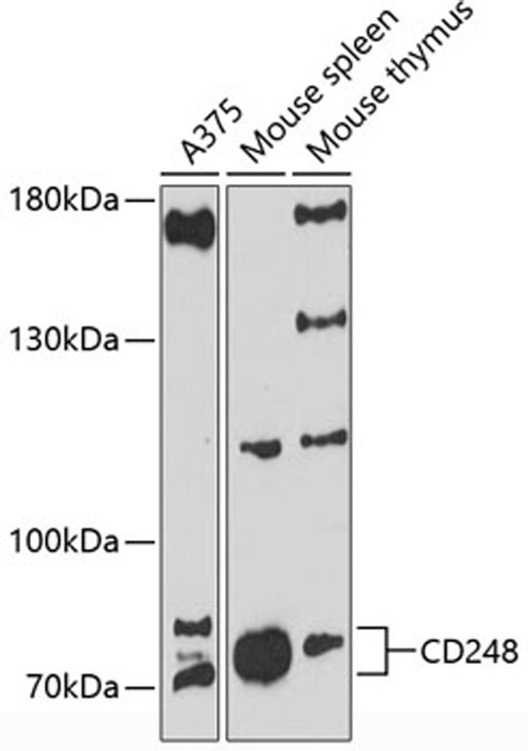 Western blot - CD248 antibody (A12703)