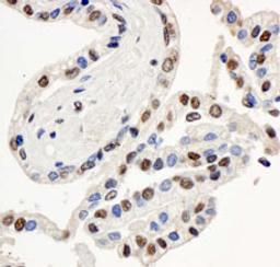 Detection of human BAF57/SMARCE1 by immunohistochemistry.