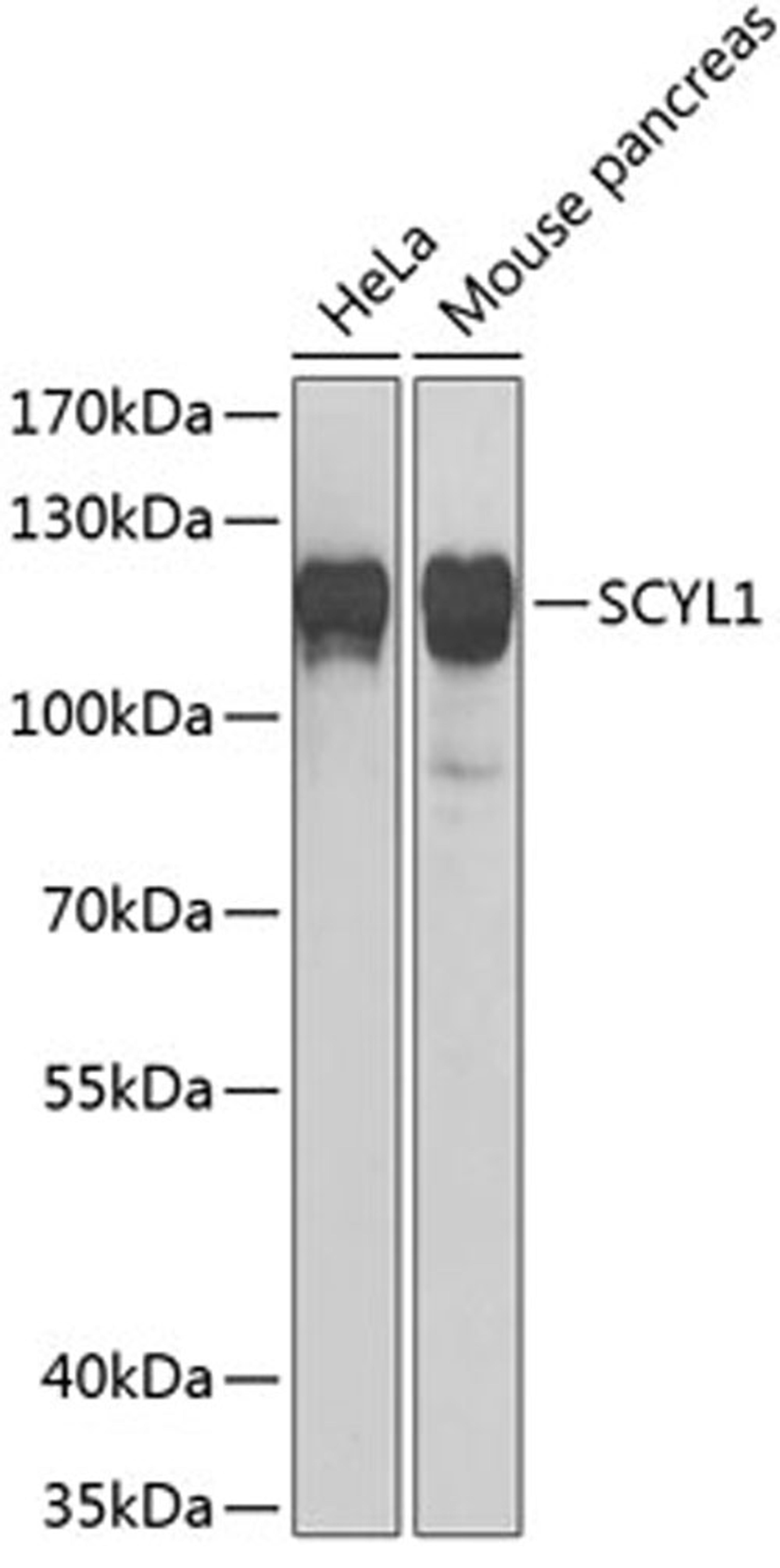 Western blot - SCYL1 Antibody (A6735)