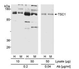 Detection of human and mouse TSC1 by western blot.