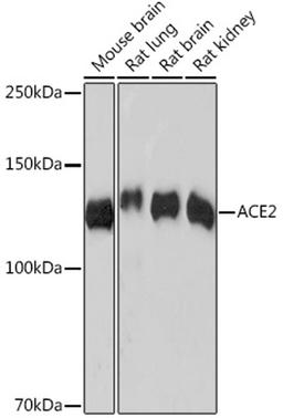 Western blot - ACE2 Rabbit mAb (A4612)