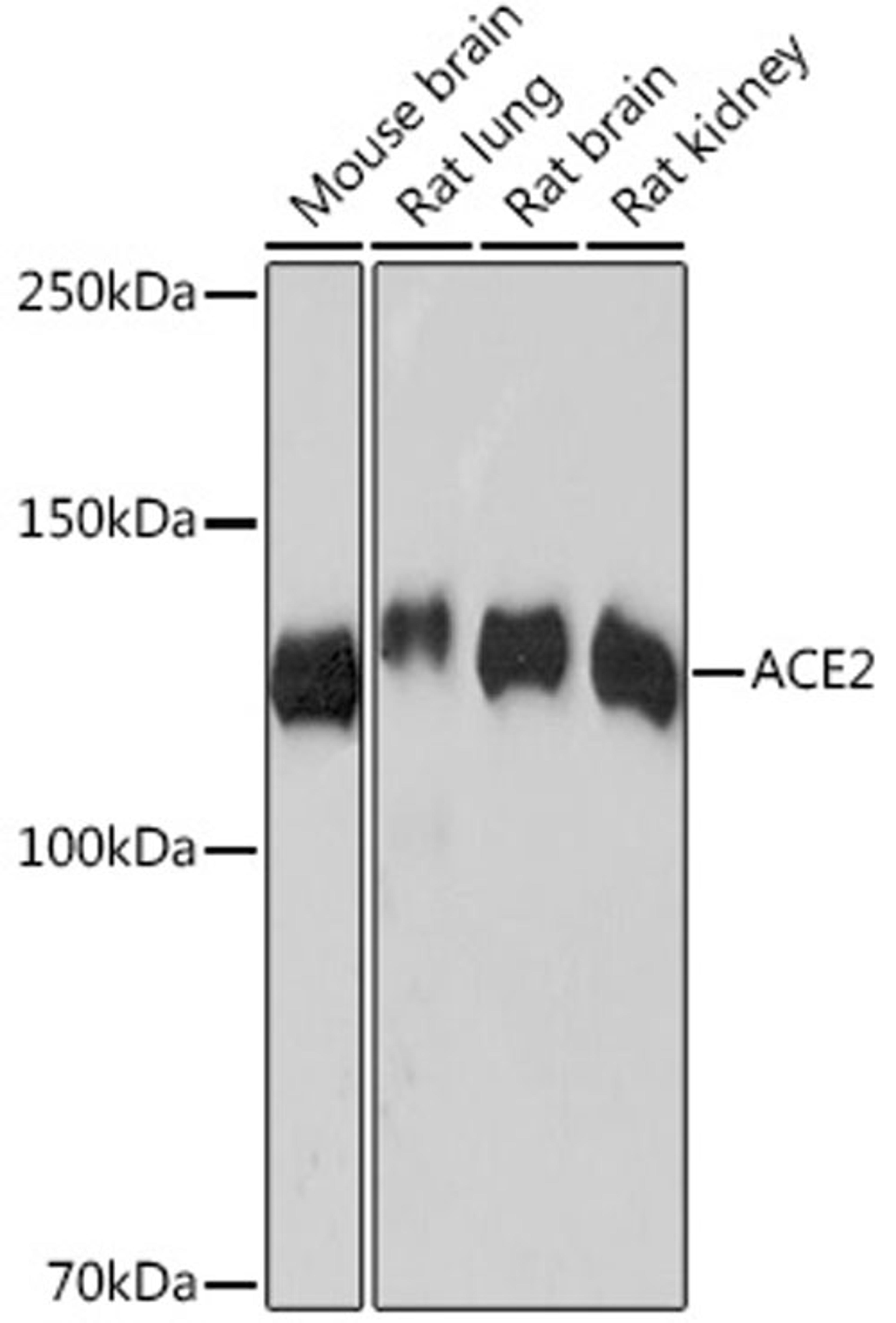 Western blot - ACE2 Rabbit mAb (A4612)