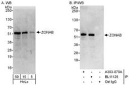 Detection of human ZONAB by western blot and immunoprecipitation.