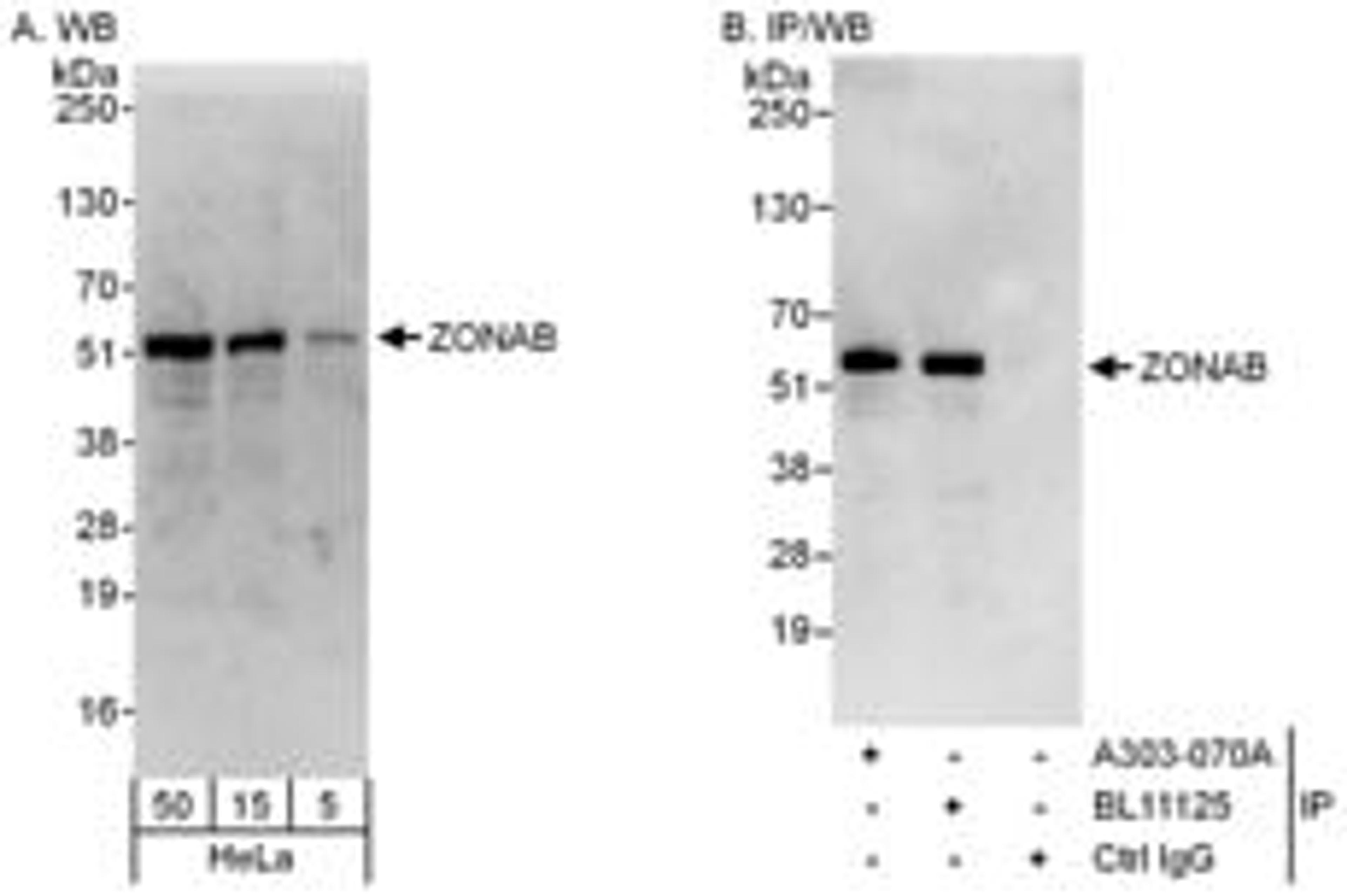 Detection of human ZONAB by western blot and immunoprecipitation.