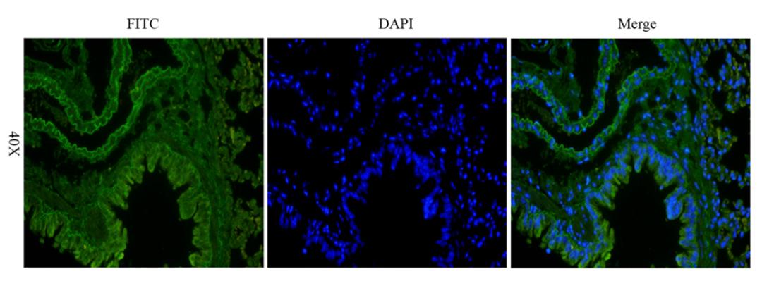 Immunofluorescence analysis of mouse lung tissue using anti-KLF2 (dilution of primary antibody - 1:200)