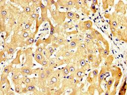 IHC image of CSB-PA019536LA01HU diluted at 1:300 and staining in paraffin-embedded human liver tissue performed on a Leica BondTM system. After dewaxing and hydration, antigen retrieval was mediated by high pressure in a citrate buffer (pH 6.0). Section was blocked with 10% normal goat serum 30min at RT. Then primary antibody (1% BSA) was incubated at 4&deg;C overnight. The primary is detected by a biotinylated secondary antibody and visualized using an HRP conjugated SP system.