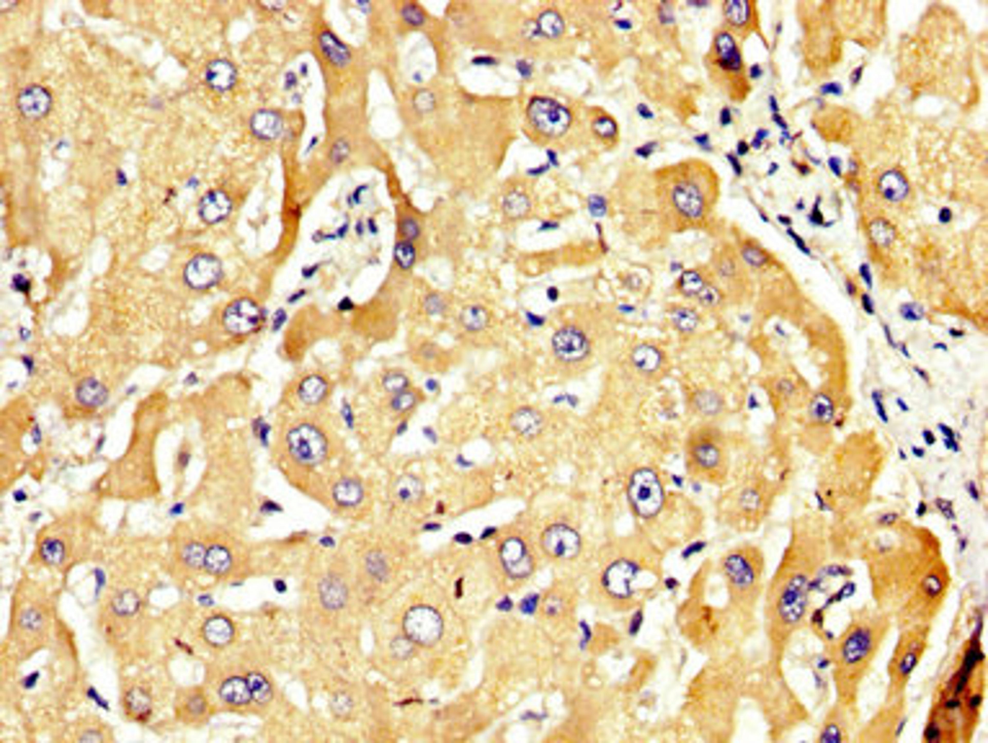 IHC image of CSB-PA019536LA01HU diluted at 1:300 and staining in paraffin-embedded human liver tissue performed on a Leica BondTM system. After dewaxing and hydration, antigen retrieval was mediated by high pressure in a citrate buffer (pH 6.0). Section was blocked with 10% normal goat serum 30min at RT. Then primary antibody (1% BSA) was incubated at 4&deg;C overnight. The primary is detected by a biotinylated secondary antibody and visualized using an HRP conjugated SP system.