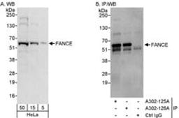 Detection of human FANCE by western blot and immunoprecipitation.