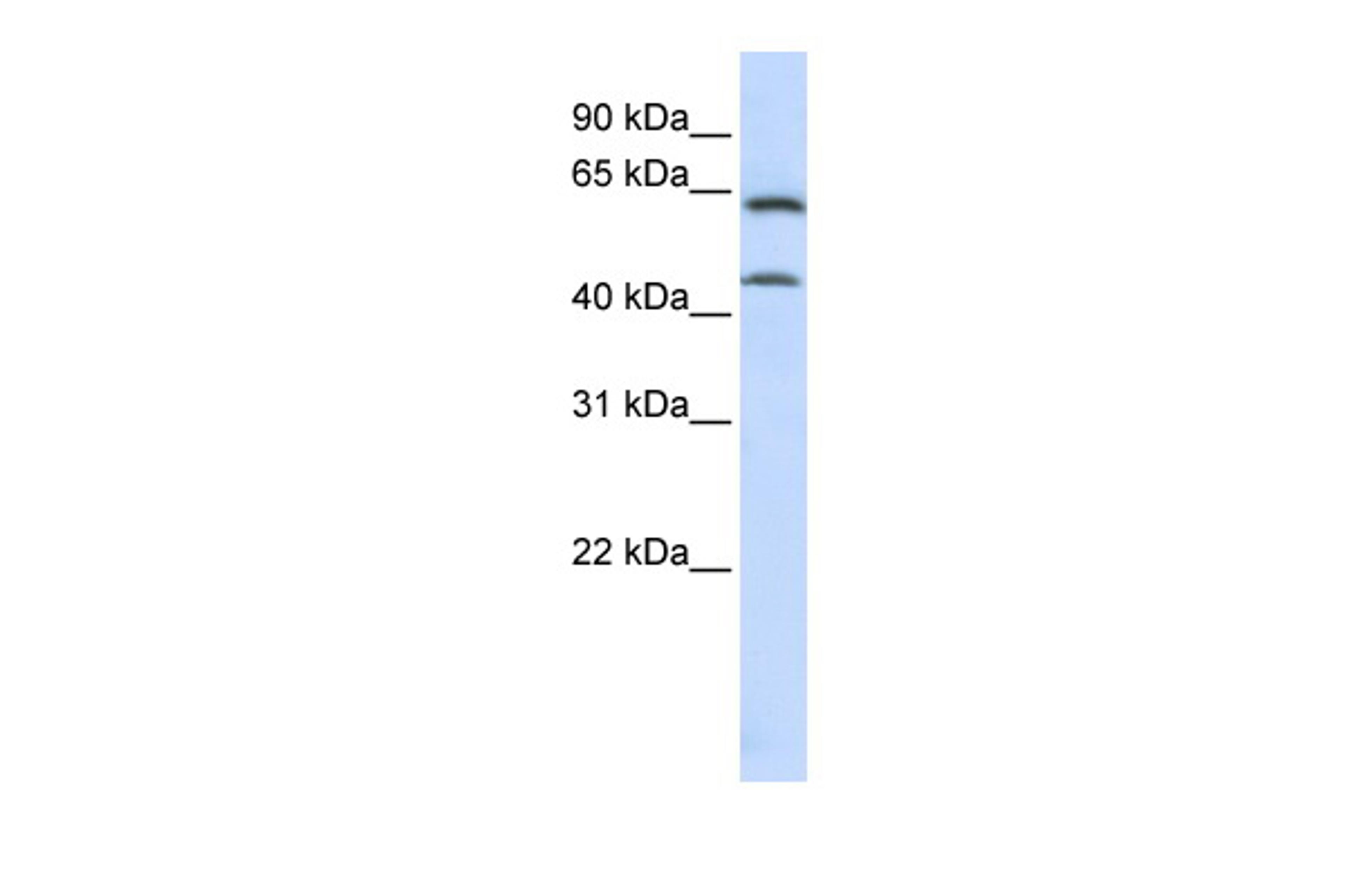 Antibody used in WB on Human MCF-7 at 0.2-1 ug/ml.