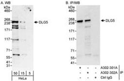 Detection of human DLG5 by western blot and immunoprecipitation.