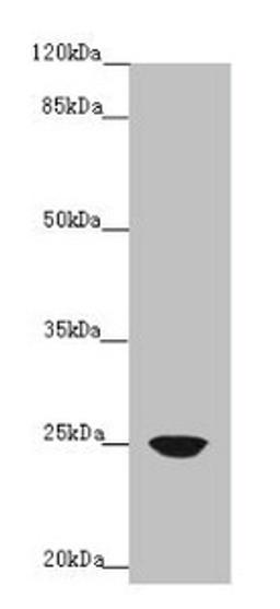 Western blot. All lanes: FAM3C antibody at 4µg/ml + A431 whole cell lysate. Secondary. Goat polyclonal to rabbit IgG at 1/10000 dilution. Predicted band size: 25 kDa. Observed band size: 25 kDa