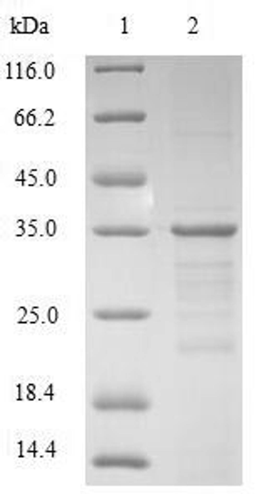 (Tris-Glycine gel) Discontinuous SDS-PAGE (reduced) with 5% enrichment gel and 15% separation gel.