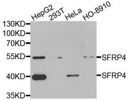 Western blot analysis of extracts of various cells using SFRP4 antibody