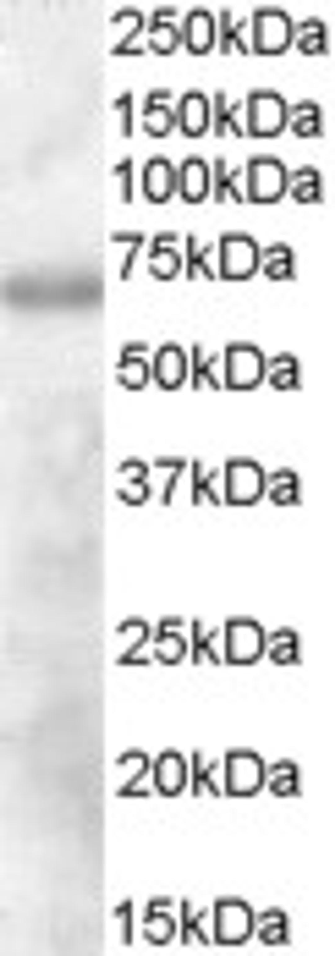 45-473 (1ug/ml) staining of Human Thymus lysate (35ug protein in RIPA buffer). Primary incubation was 1 hour. Detected by chemiluminescence.