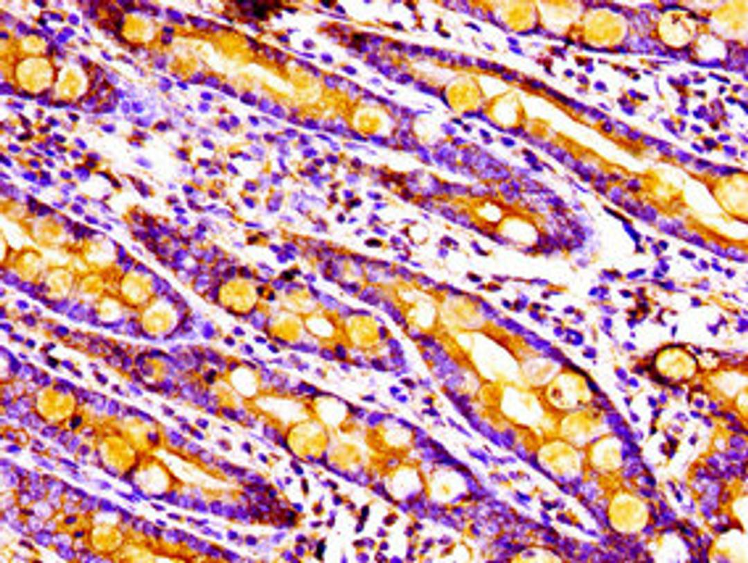 Immunohistochemistry of paraffin-embedded human small intestine tissue using CSB-PA014770LA01HU at dilution of 1:100