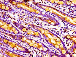 Immunohistochemistry of paraffin-embedded human small intestine tissue using CSB-PA014770LA01HU at dilution of 1:100