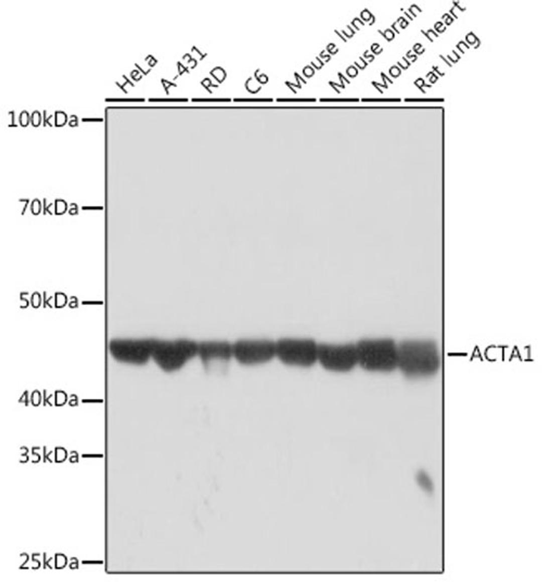 Western blot - ACTA1 Rabbit mAb (A2321)