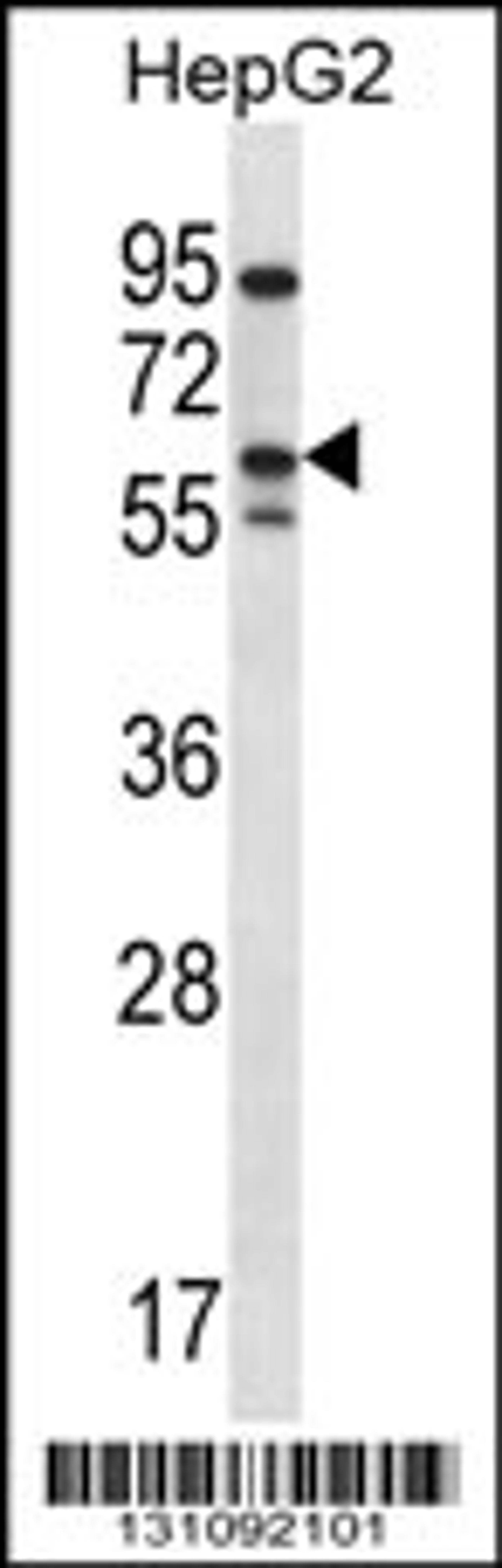 Western blot analysis in HepG2 cell line lysates (35ug/lane).