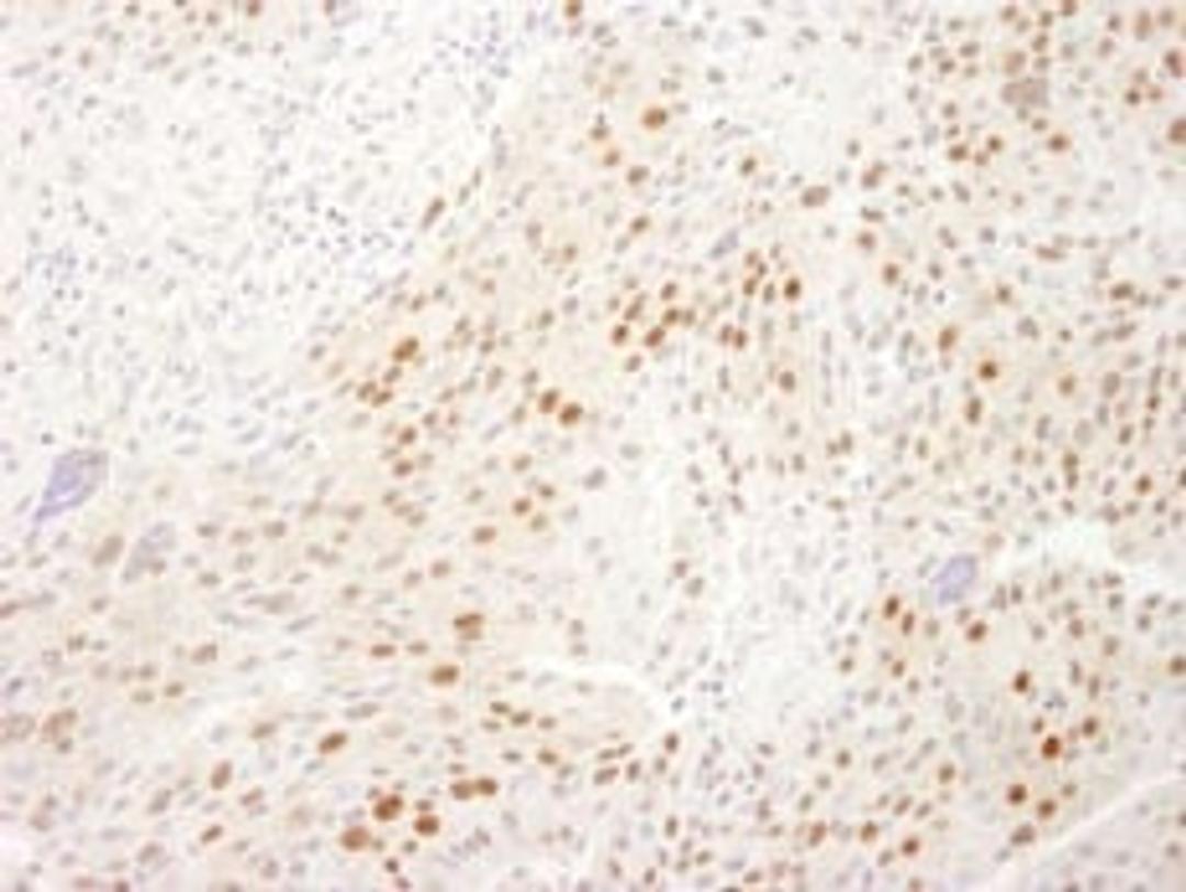 Detection of human WDR77/MEP50 by immunohistochemistry.