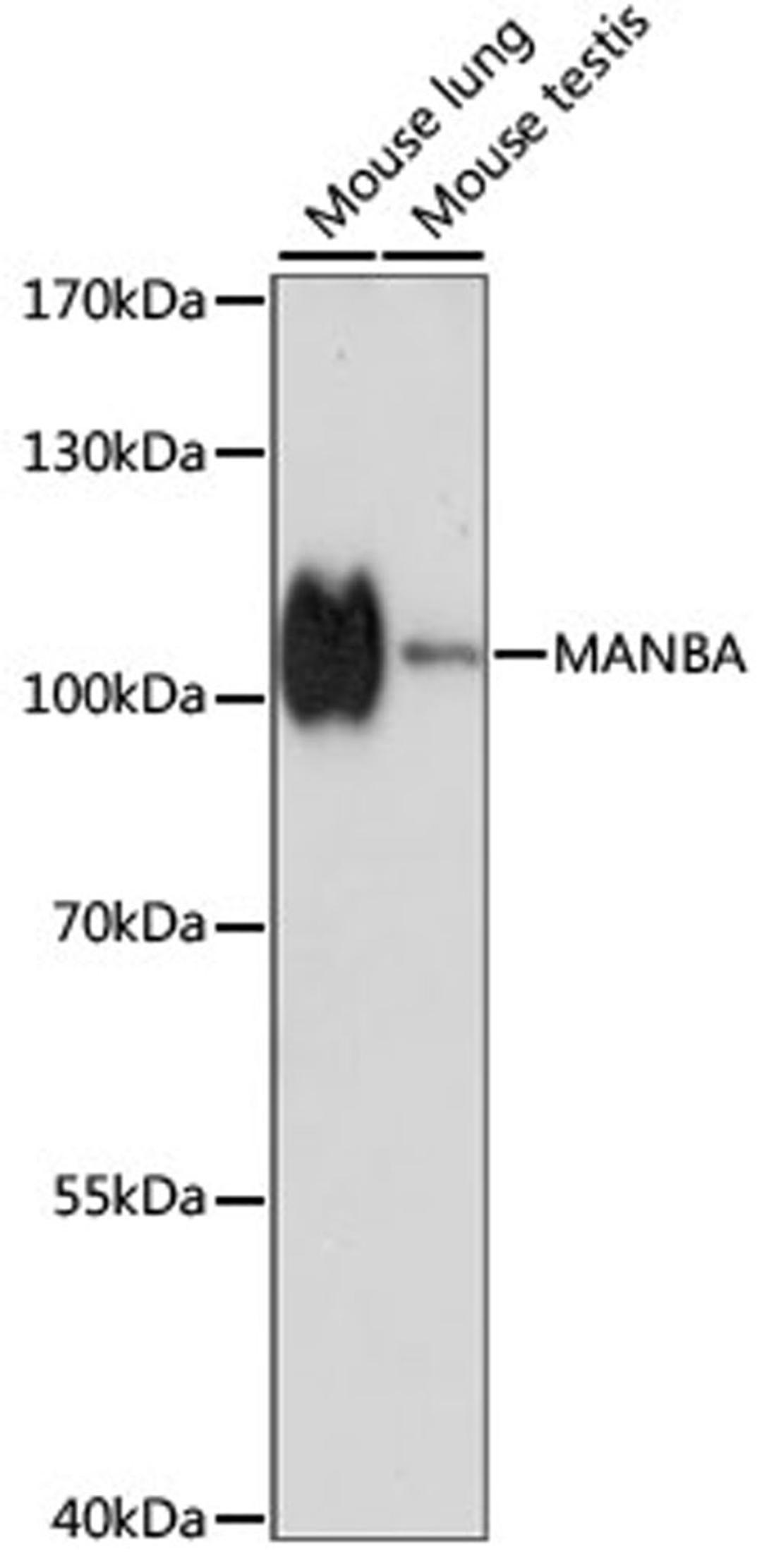 Western blot - MANBA antibody (A15289)