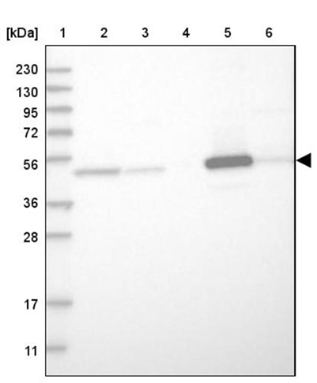 Western Blot: PCYT2 Antibody [NBP1-83951] - Lane 1: Marker [kDa] 230, 130, 95, 72, 56, 36, 28, 17, 11<br/>Lane 2: Human cell line RT-4<br/>Lane 3: Human cell line U-251MG sp<br/>Lane 4: Human plasma (IgG/HSA depleted)<br/>Lane 5: Human liver tissue<br/>Lane 6: Human tonsil tissue