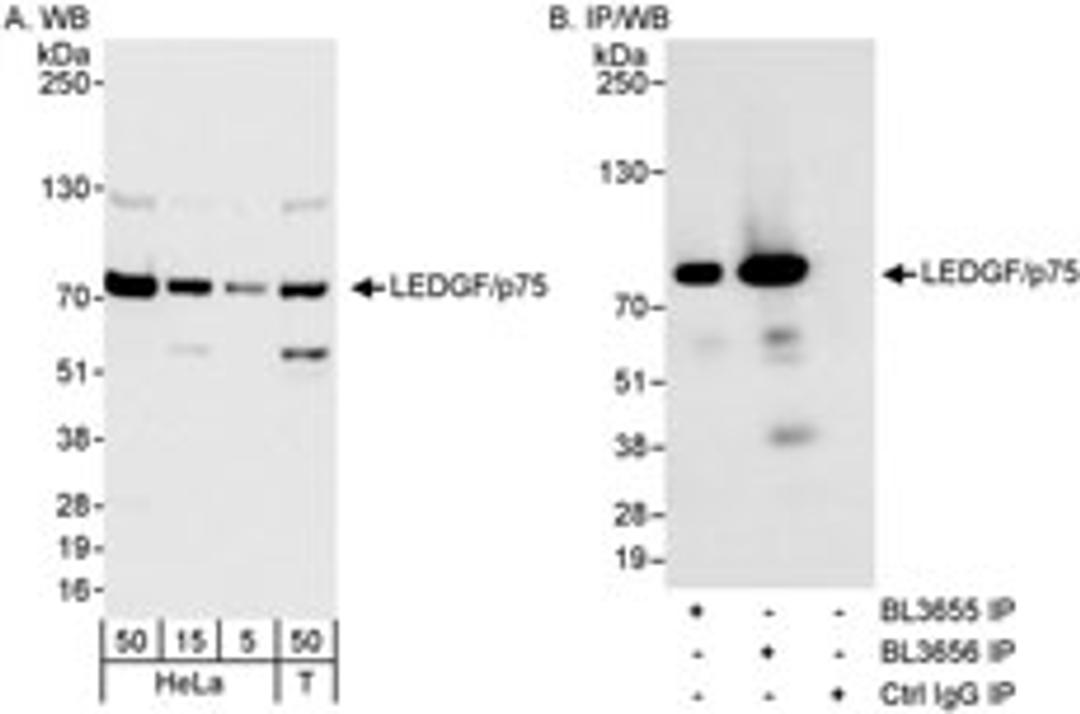 Detection of human LEDGF/p75 by western blot and immunoprecipitation.