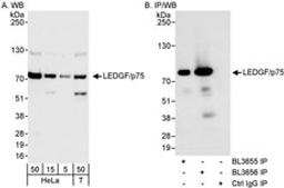 Detection of human LEDGF/p75 by western blot and immunoprecipitation.