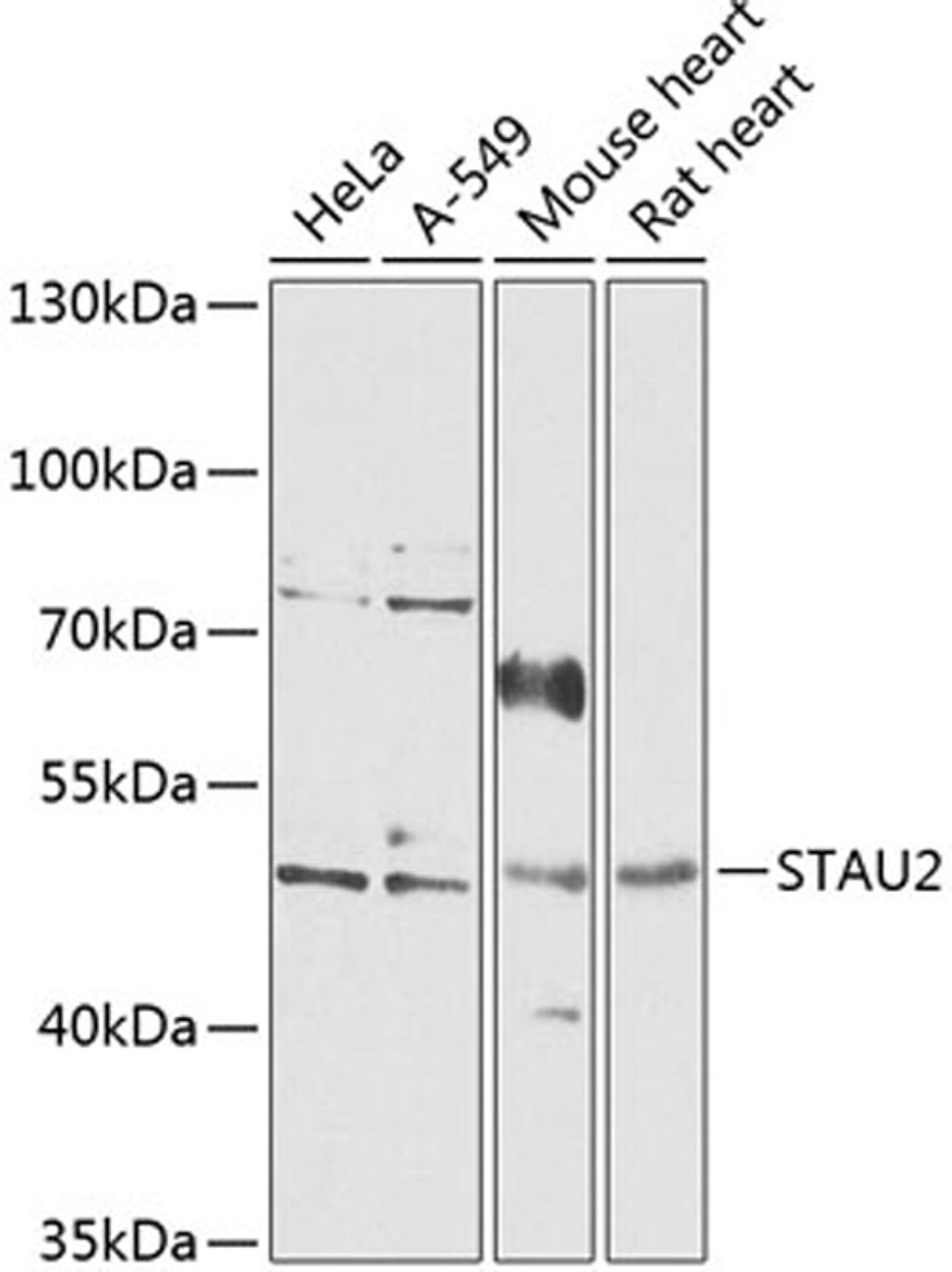 Western blot - STAU2 antibody (A14117)