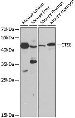 Western blot - CTSE antibody (A2678)