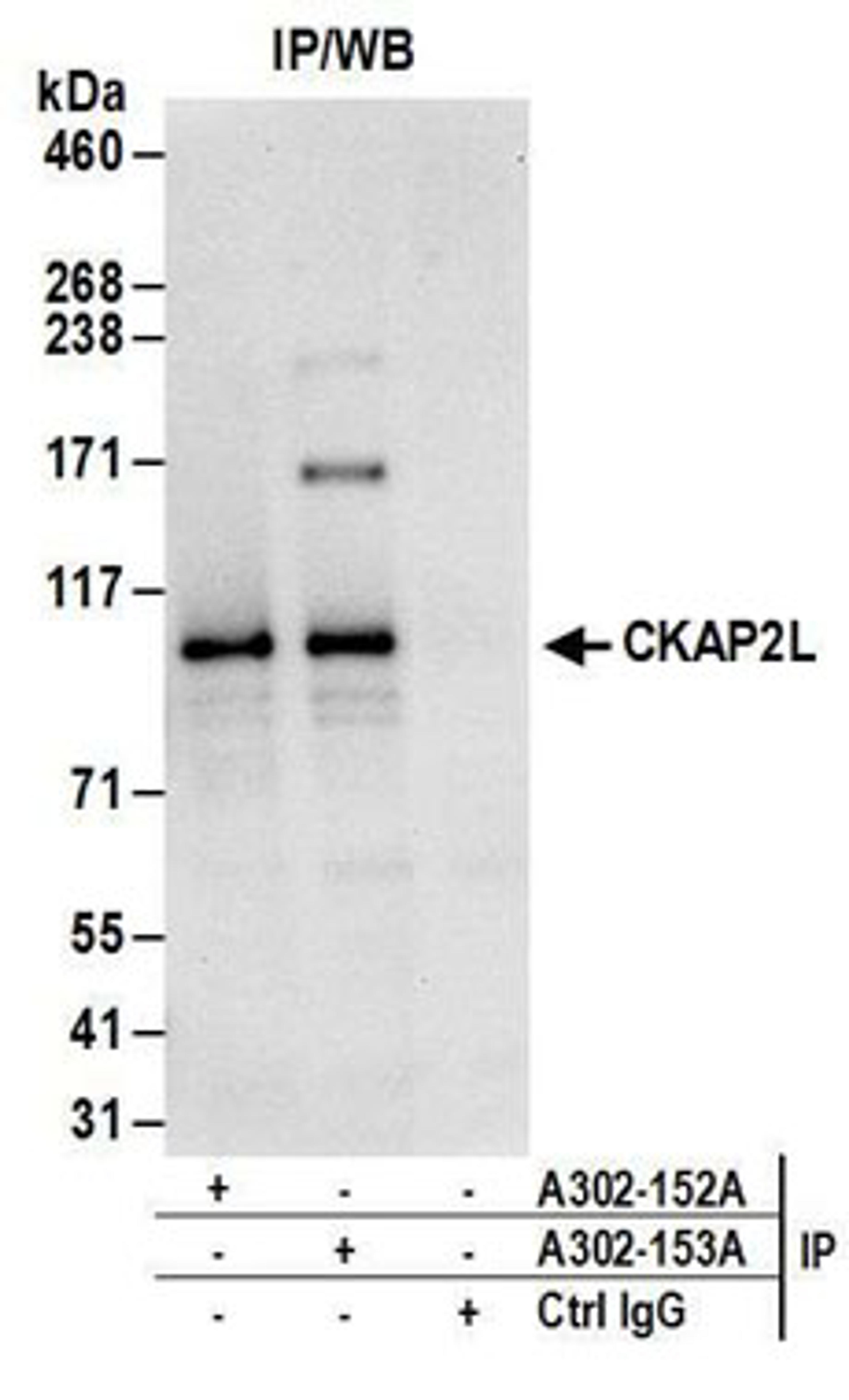 Detection of human CKAP2L by western blot of immunoprecipitates.