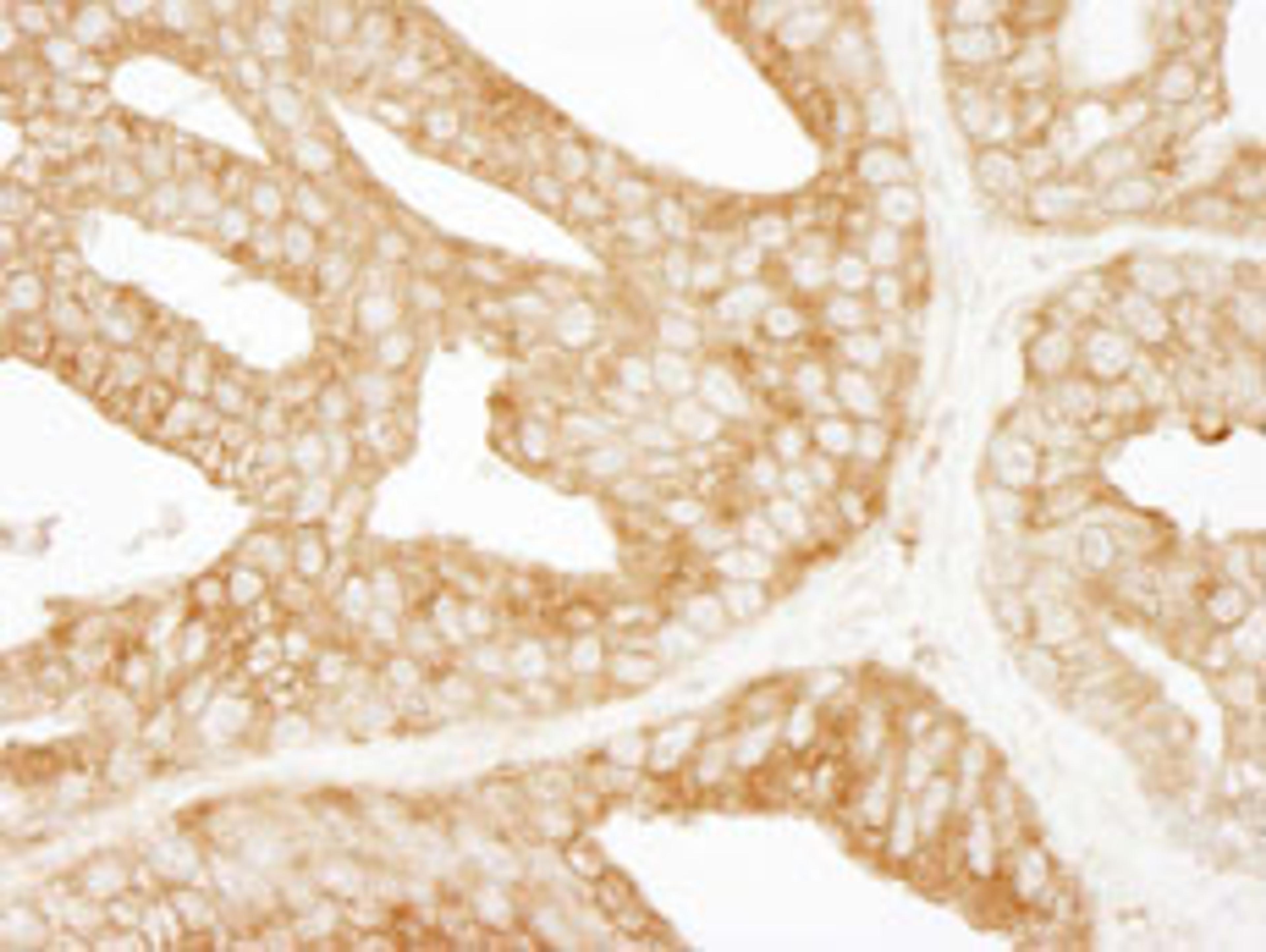 Detection of human EPS15 by immunohistochemistry.