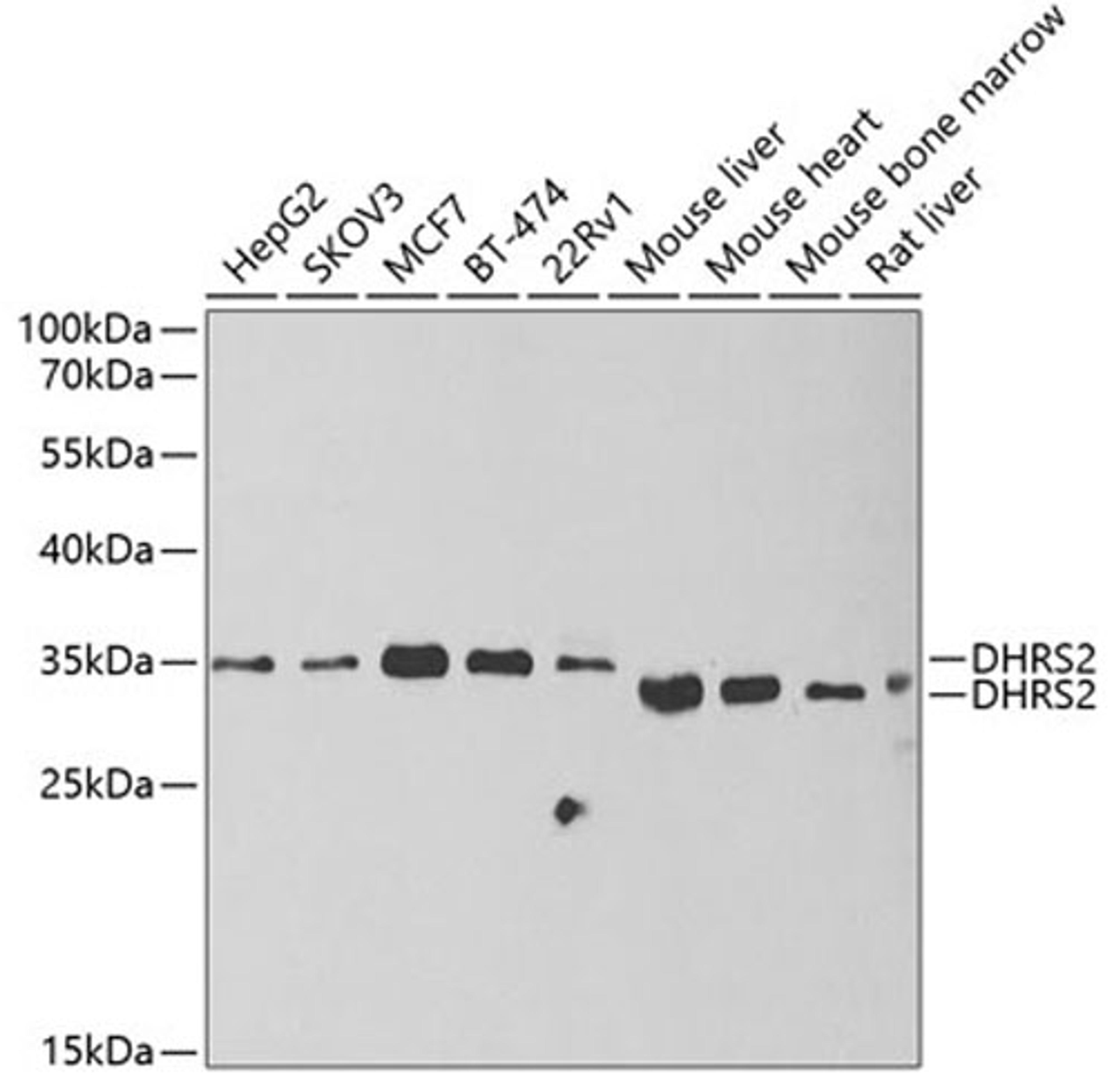 Western blot - DHRS2 antibody (A6446)