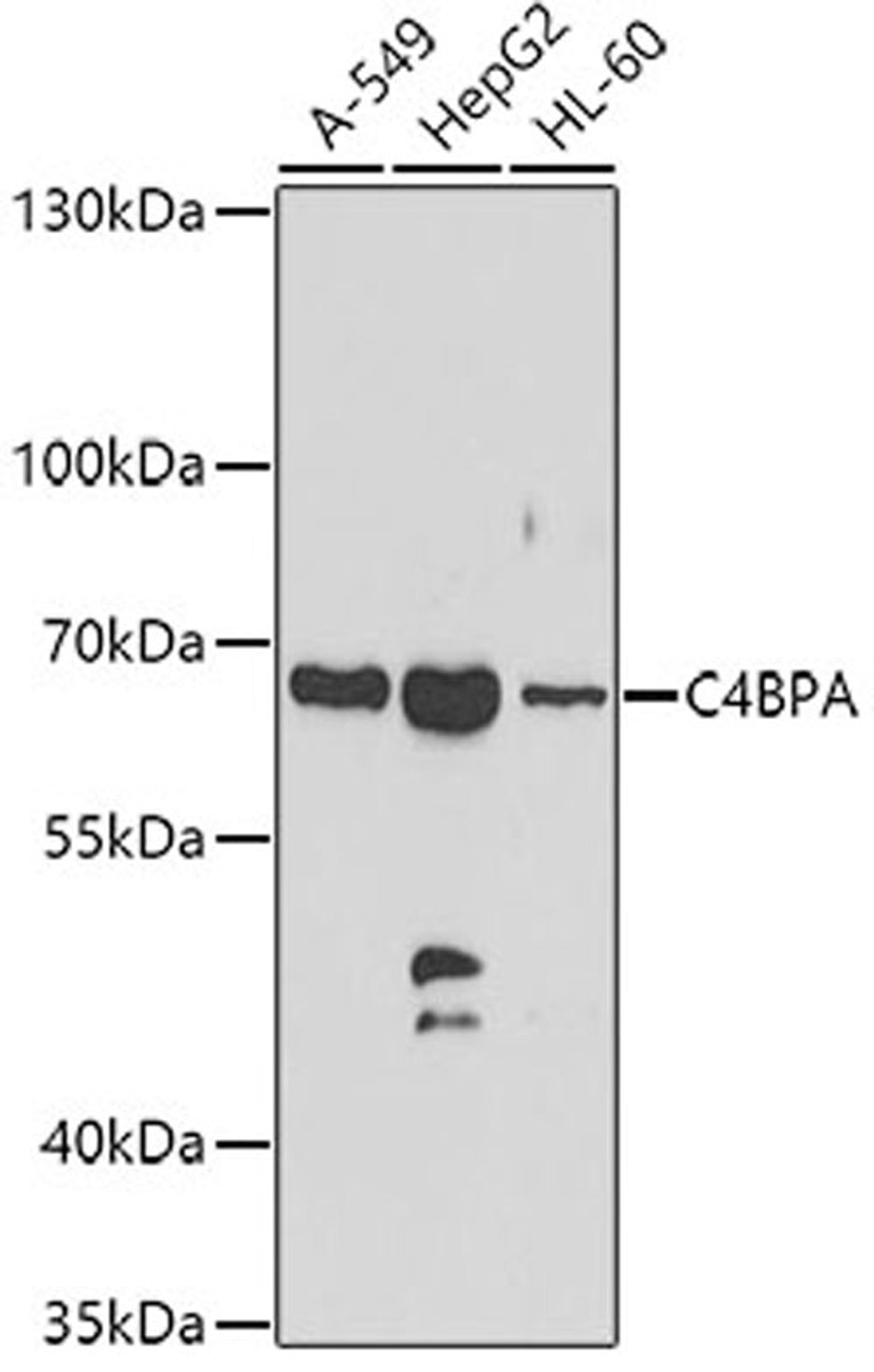 Western blot - C4BPA antibody (A7648)