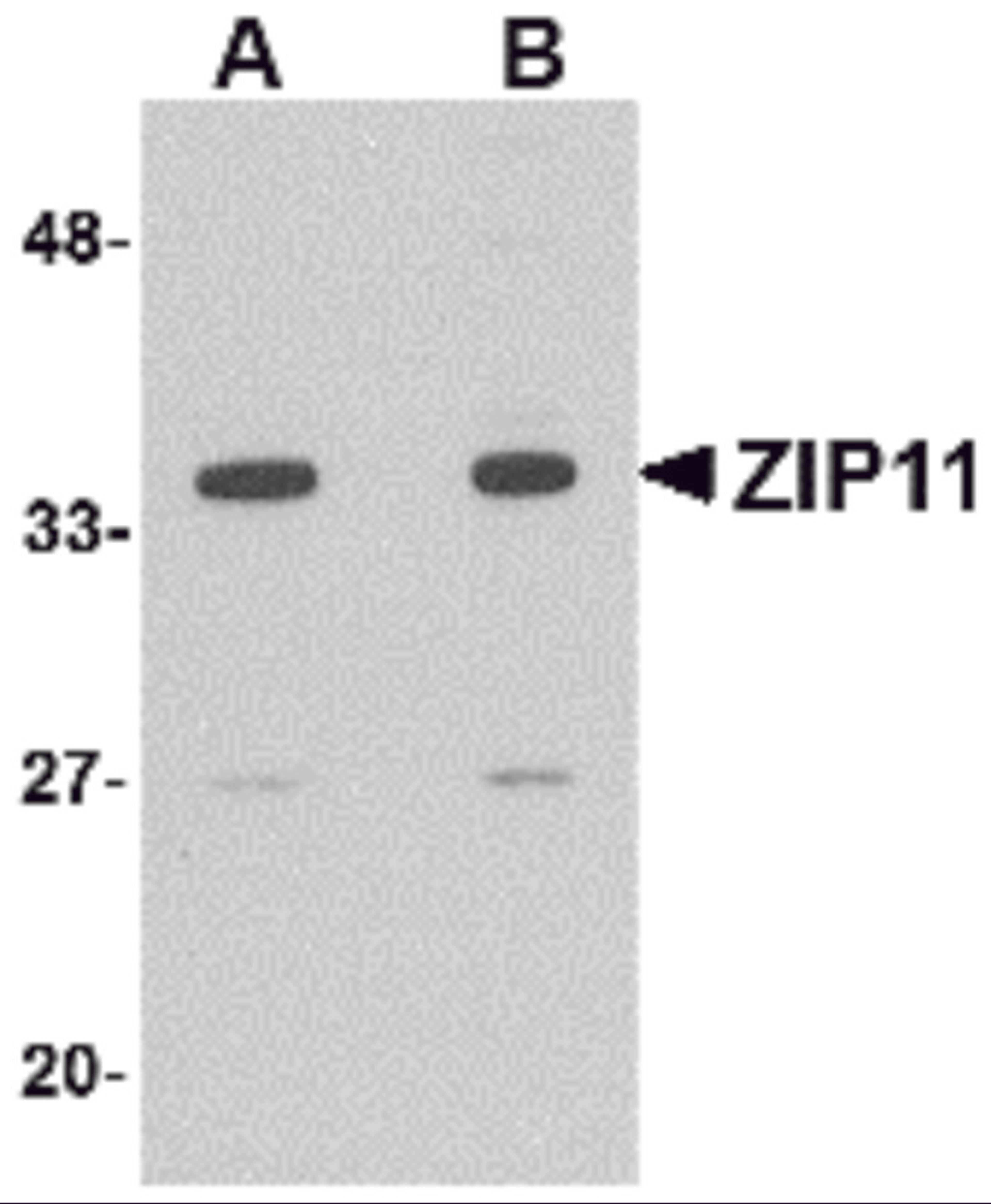 Western blot analysis of ZIP11 in mouse kidney tissue lysate with ZIP11 antibody at (A) 1 and (B) 2 μg/mL.