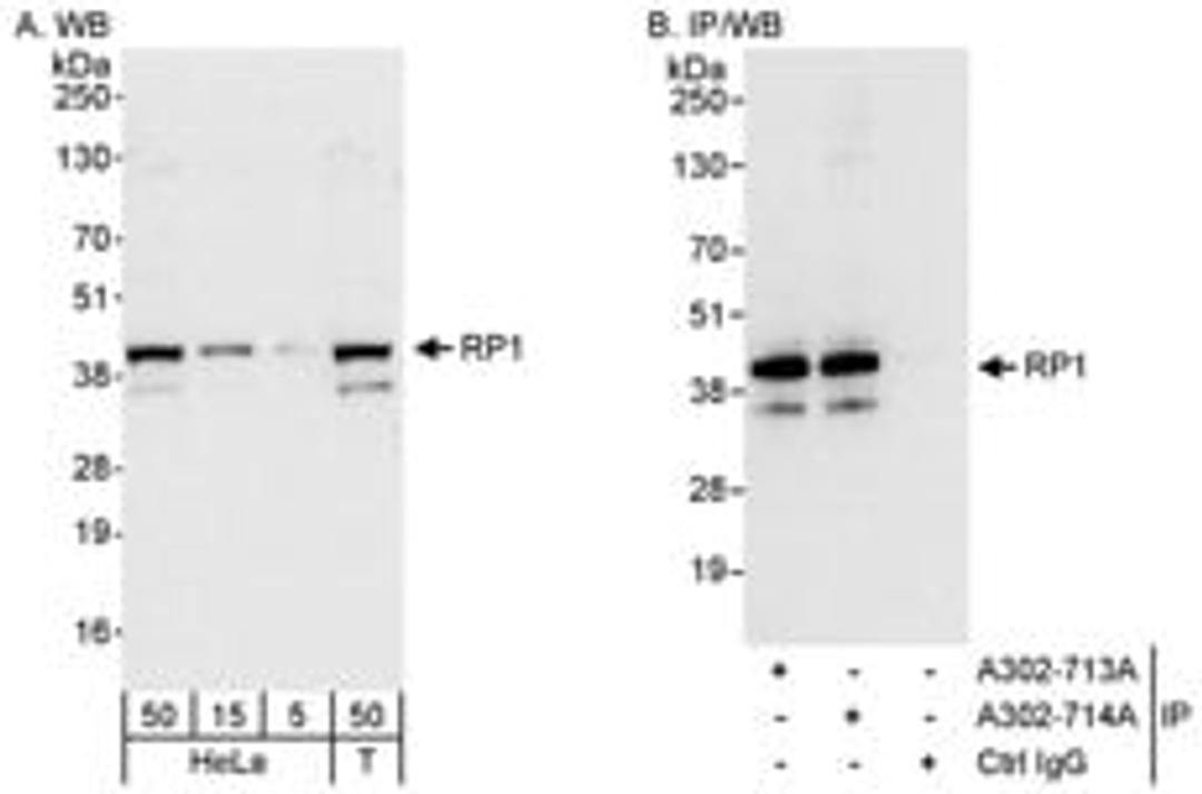 Detection of human RP1 by western blot and immunoprecipitation.