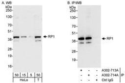 Detection of human RP1 by western blot and immunoprecipitation.