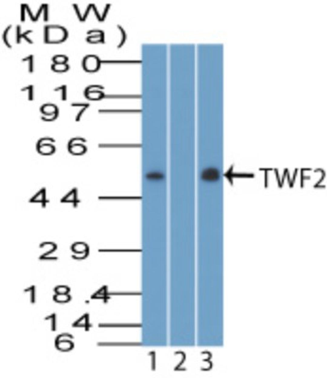 Western Blot: TWF2 Antibody [NBP2-27171] - Analysis of TWF2. Jurkat lysate in the 1) absence and 2) presence of immunizing peptide, and 3) NIH3T3 lysate probed with 5 ug/ml of TWF2 antibody. Goat anti-rabbit Ig HRP secondary antibody and PicoTect ECL substrate solution were used for this test.