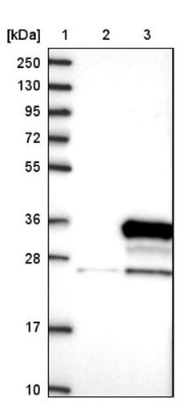 Western Blot: N4BP2L1 Antibody [NBP1-84531] - Lane 1: Marker [kDa] 250, 130, 95, 72, 55, 36, 28, 17, 10<br/>Lane 2: Negative control (vector only transfected HEK293T lysate)<br/>Lane 3: Over-expression lysate (Co-expressed with a C-terminal myc-DDK tag (~3.1 kDa) in mammalian HEK293T cells, LY409475)