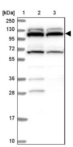 Western Blot: RNF111 Antibody [NBP1-94140] - Lane 1: Marker [kDa] 250, 130, 95, 72, 55, 36, 28, 17, 10<br/>Lane 2: Human cell line RT-4<br/>Lane 3: Human cell line U-251MG sp