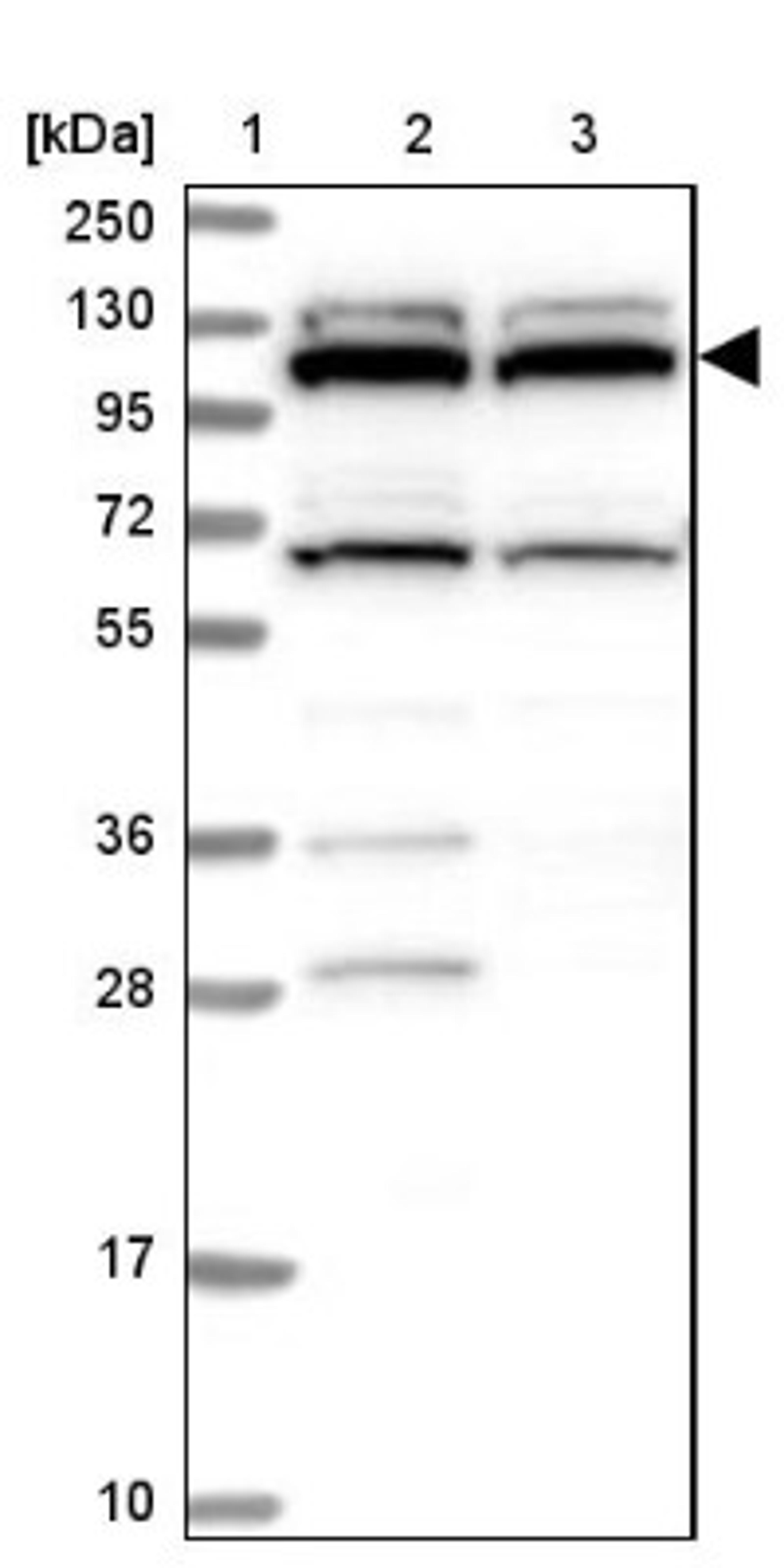 Western Blot: RNF111 Antibody [NBP1-94140] - Lane 1: Marker [kDa] 250, 130, 95, 72, 55, 36, 28, 17, 10<br/>Lane 2: Human cell line RT-4<br/>Lane 3: Human cell line U-251MG sp