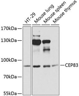 Western blot - CEP83 antibody (A8491)