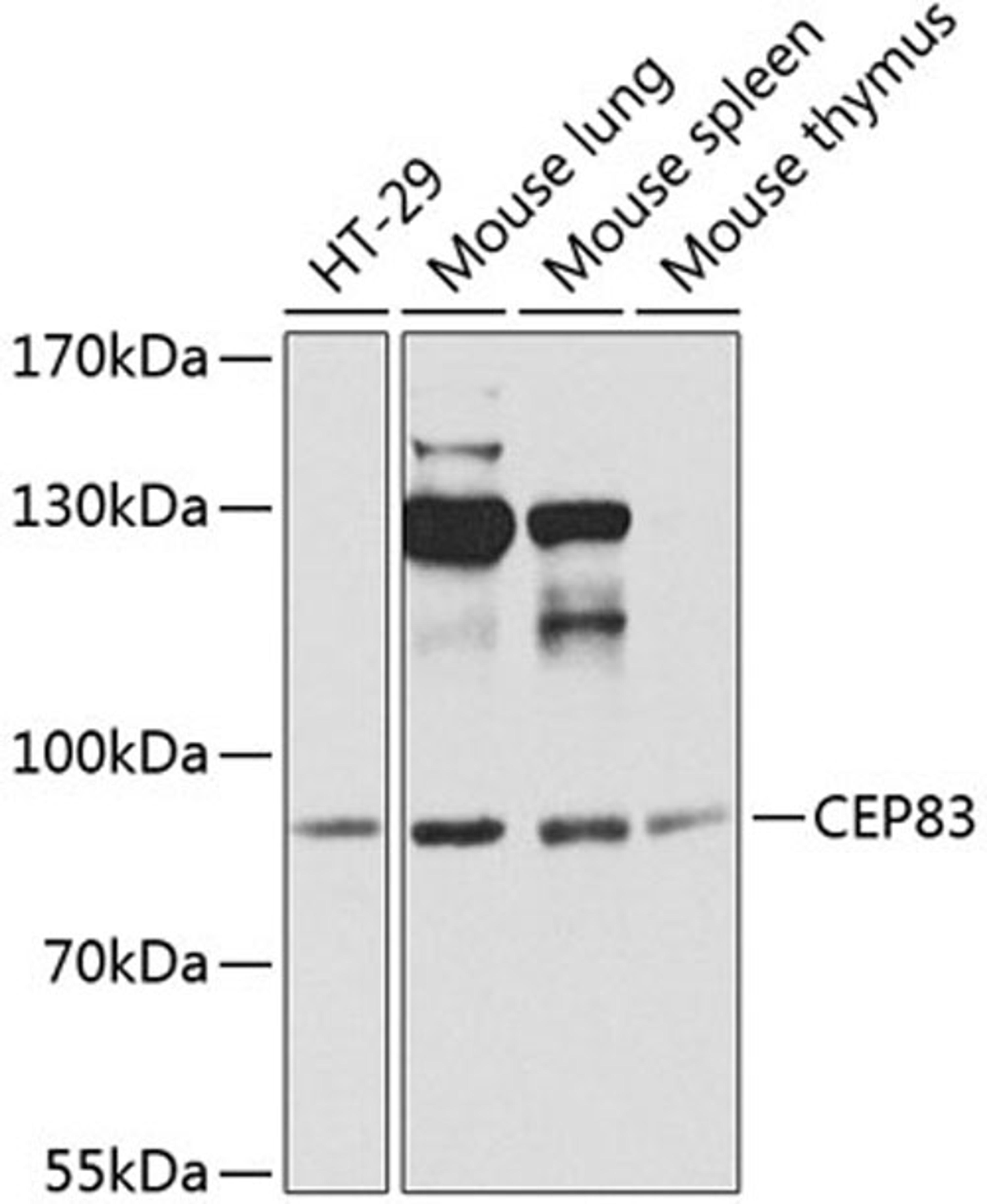 Western blot - CEP83 antibody (A8491)