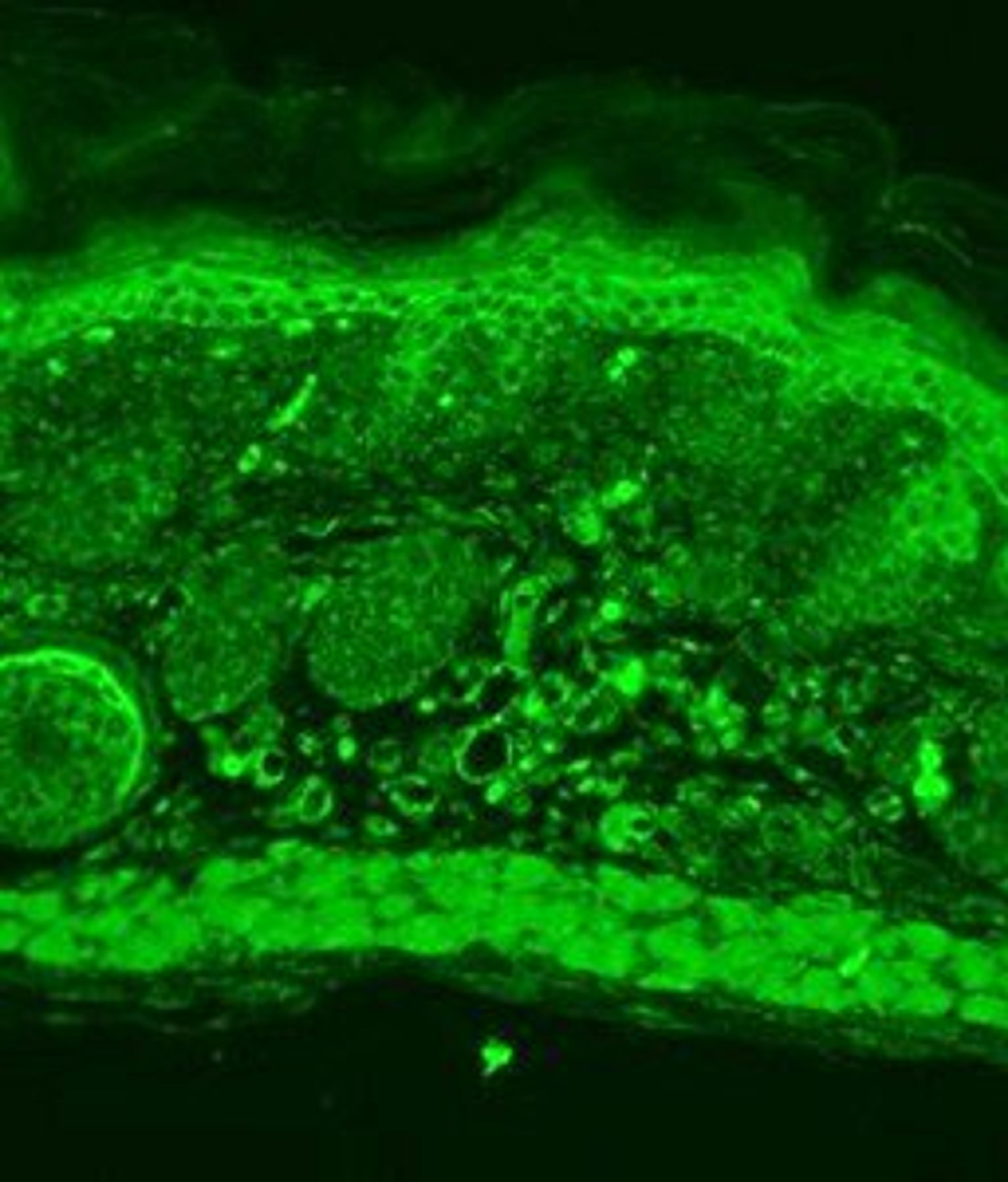 Confocal Immunofluorescence analysis of mouse backskin sections using Kir2.2 antibody