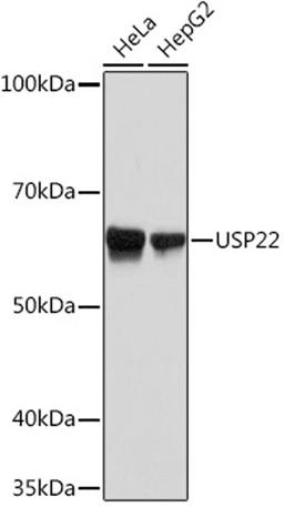 Western blot - USP22 Rabbit mAb (A9261)