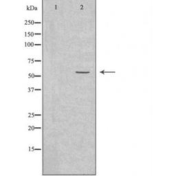 Western blot analysis of Jurkat cells using 2A6 (Cytochrome P450) antibody