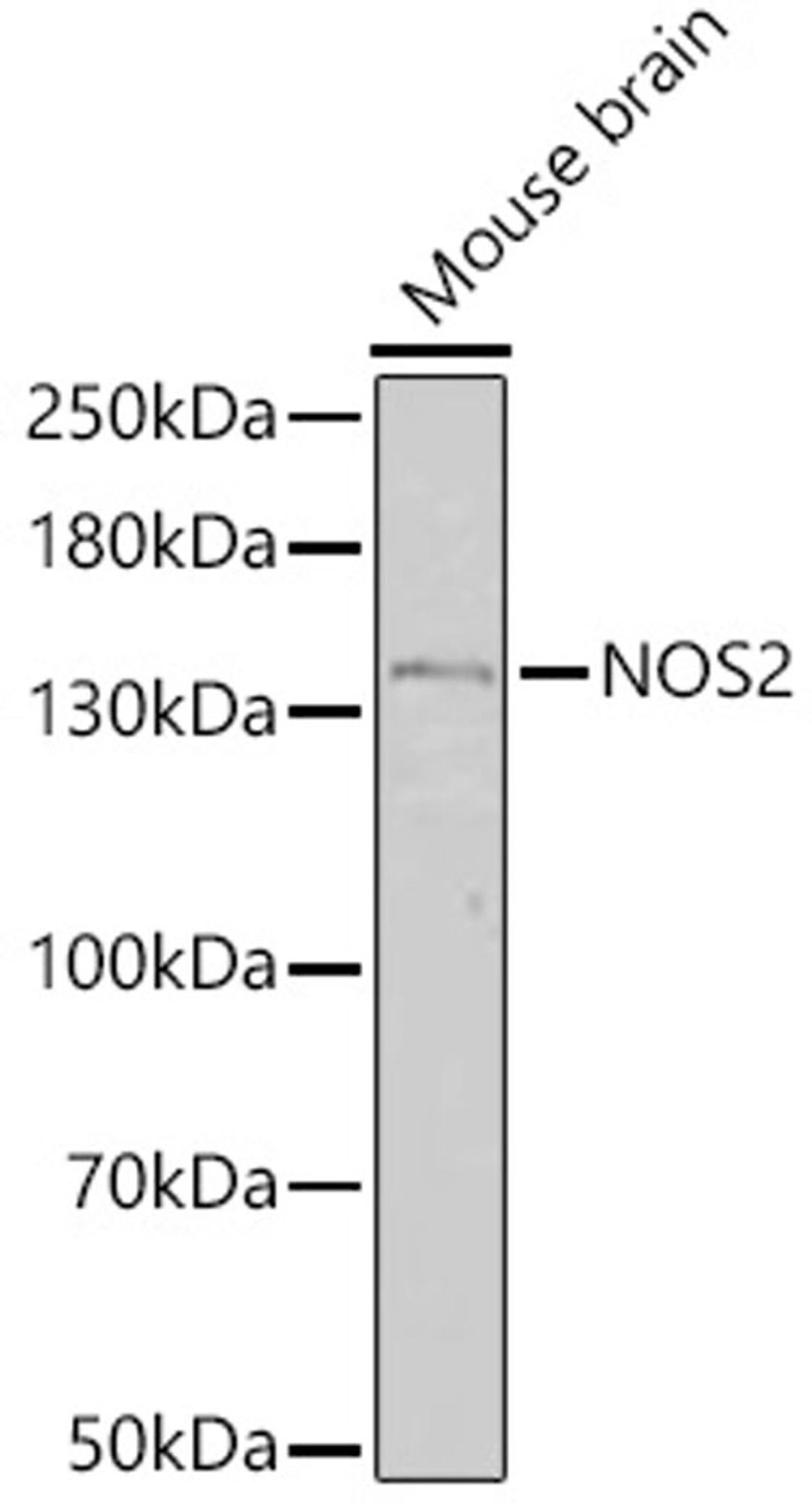 Western blot - NOS2 antibody (A18247)