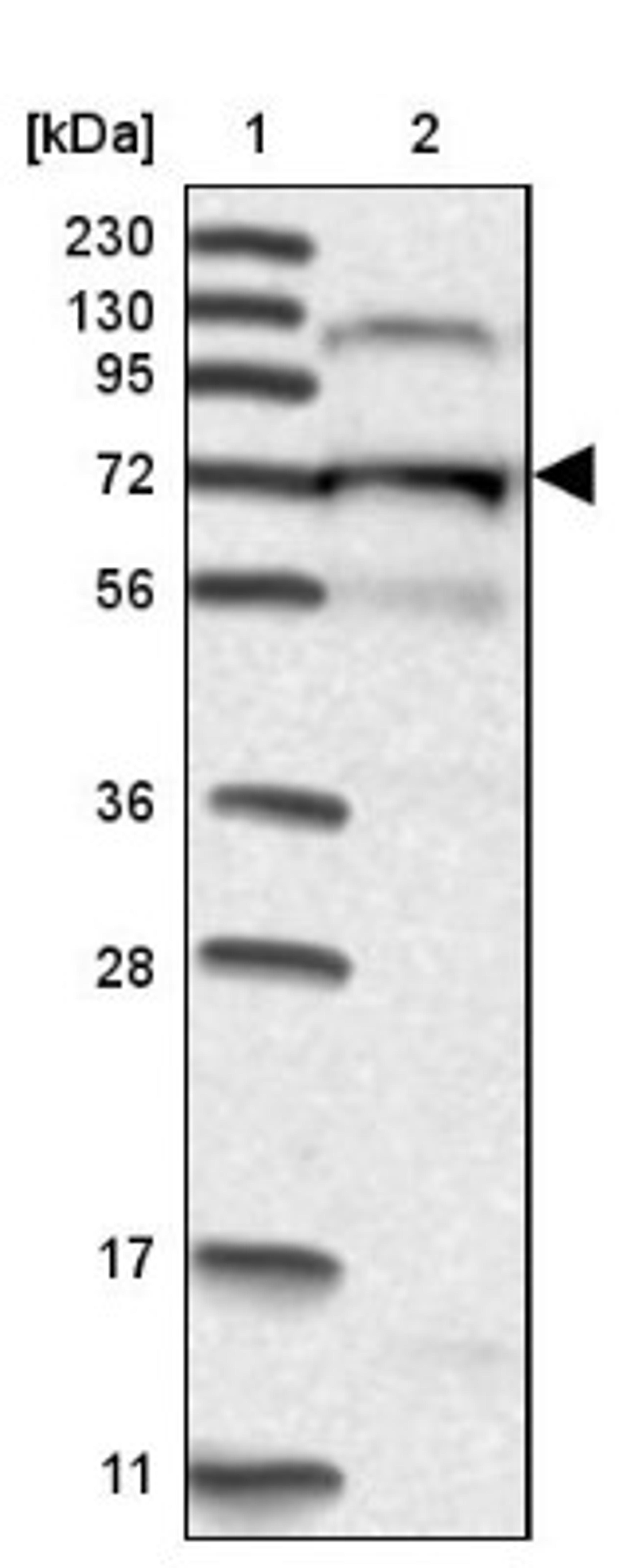 Western Blot: KLC4 Antibody [NBP1-88772] - Lane 1: Marker [kDa] 230, 130, 95, 72, 56, 36, 28, 17, 11<br/>Lane 2: Human cell line RT-4