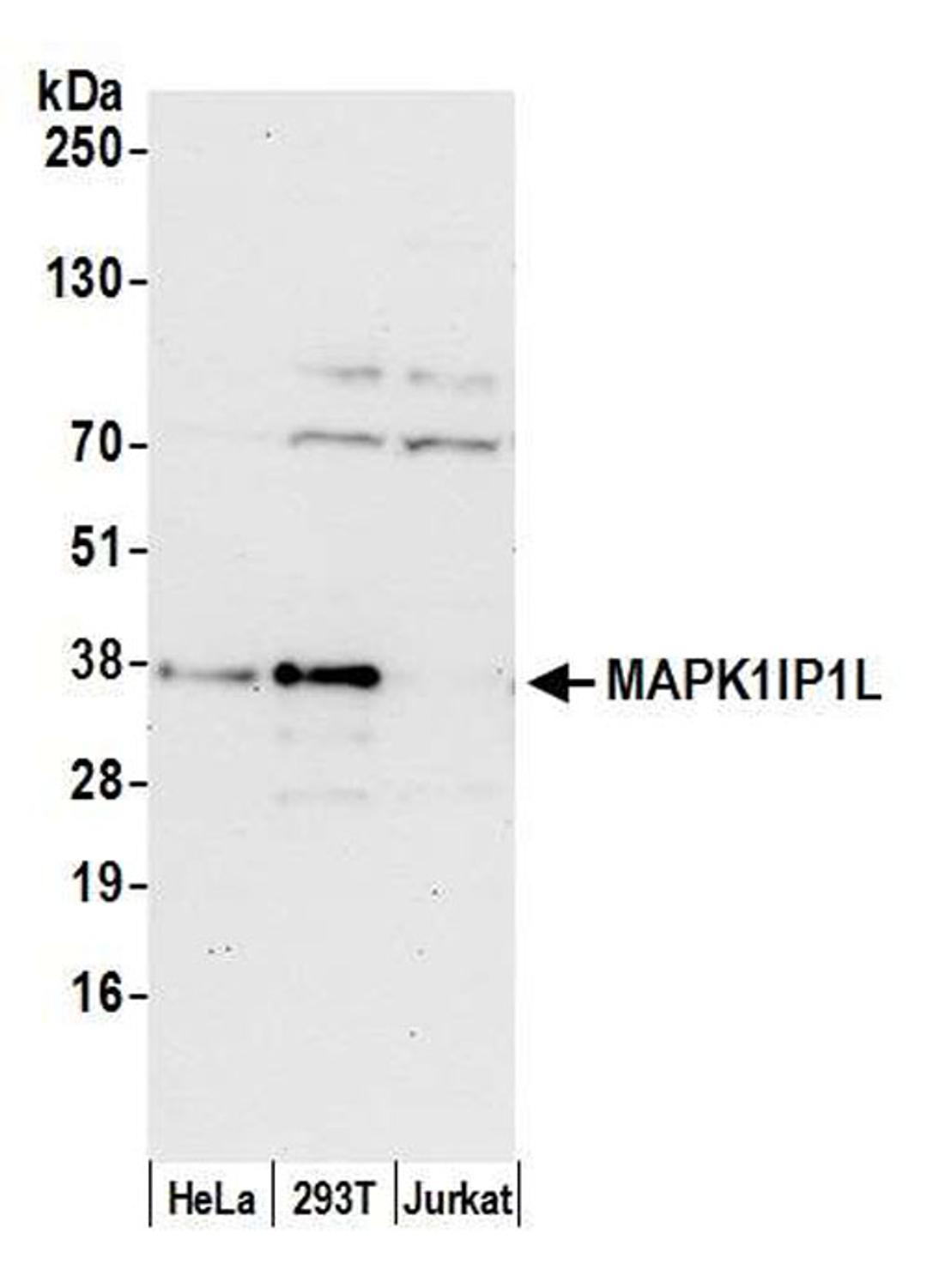 Detection of human MAPK1IP1L by WB.