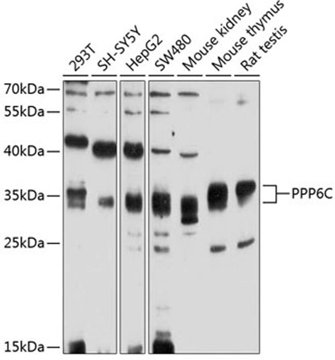 Western blot - PPP6C antibody (A4039)