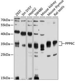 Western blot - PPP6C antibody (A4039)